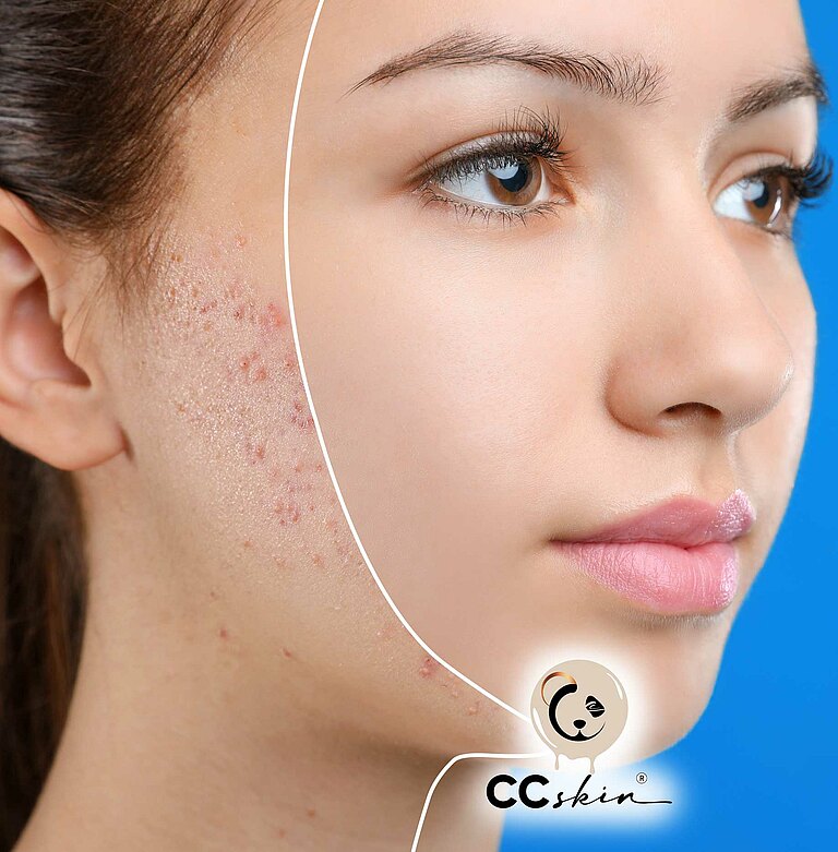 CC-SKIN