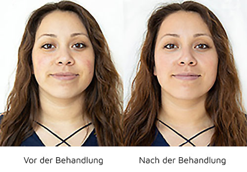 before after