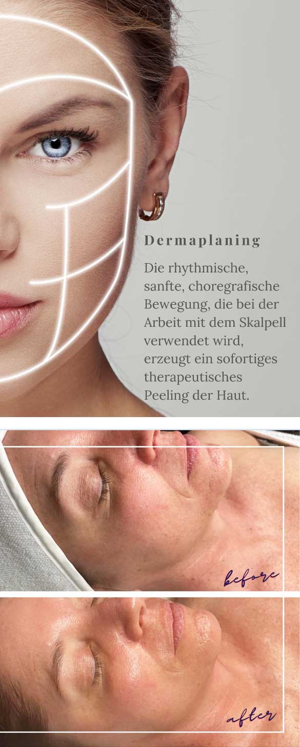 Dermaplaning